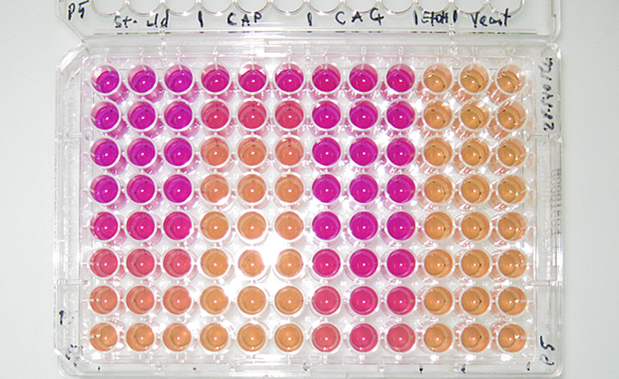 Bioassays for Detecting Estrogenic Substances in Surface Waters - Comparison of Five in Vitro Assays