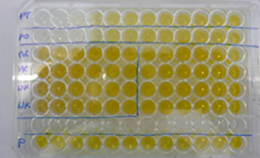 Acetylcholinesterase Inhibition