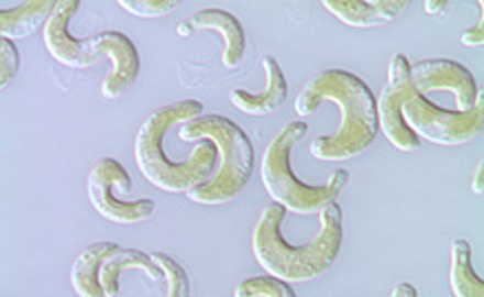 Combined Algae Test with Unicellular Green Algae